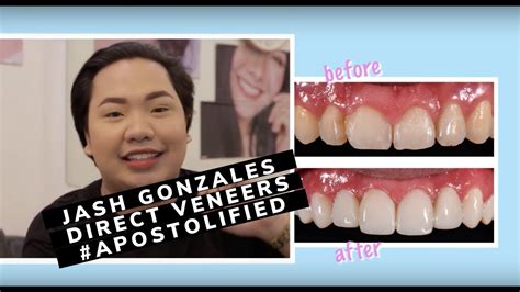 Cosmetic Dentists Makati .